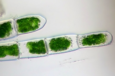 Microalgae: A Sustainable Solution for Fish Feed