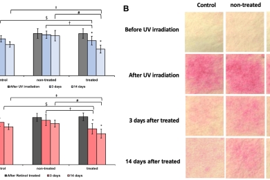 Anti-inflammatory effects of<span style="font-style:italic;"> Nephelium lappaceum </span>peel extract and geraniin on external skin stimulation